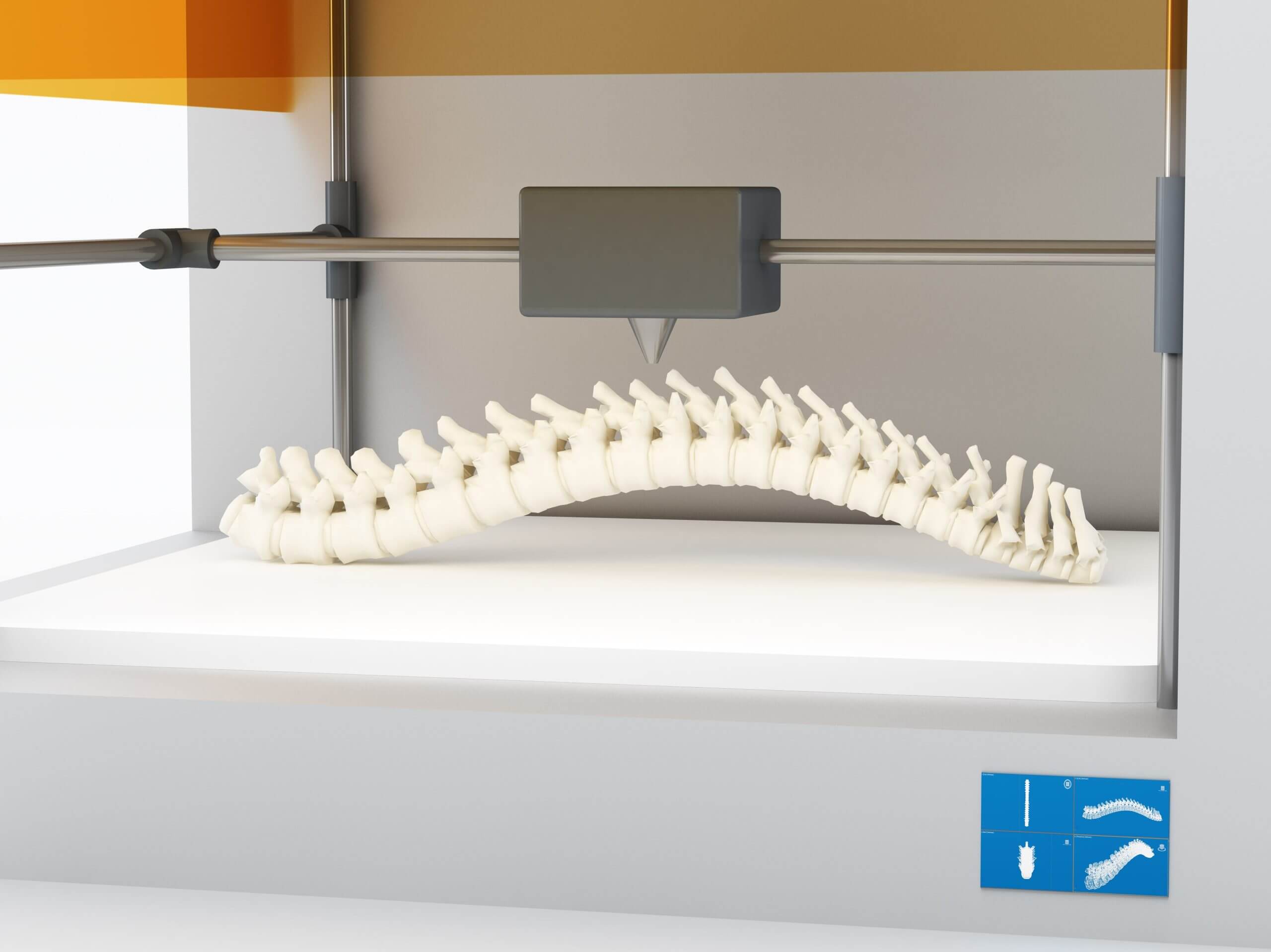 Modèle 3D d'une colonne vertébrale imprimée en grand format, visible dans une imprimante 3D professionnelle.